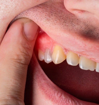 Emergency Dental Association