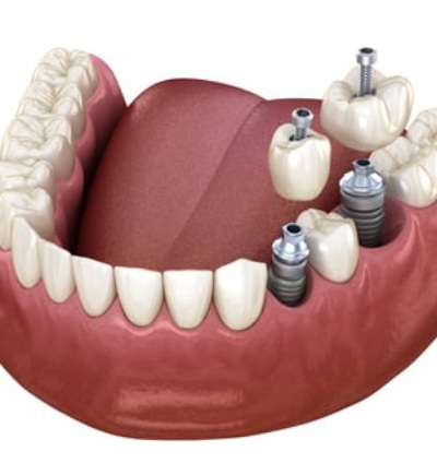 Emergency Dental Association